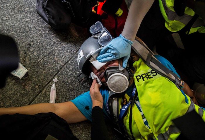 AJI Kecam Aksi Penembakan Polisi Hong Kong pada Veby Indah
