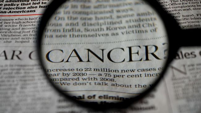 Mengenal Kanker Usus Besar, Penyakit Chadwick Boseman Selama 4 Tahun