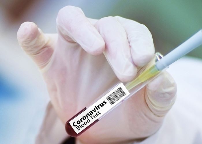 Inggris Uji Coba Vaksin Virus Corona Pertama pada Manusia 