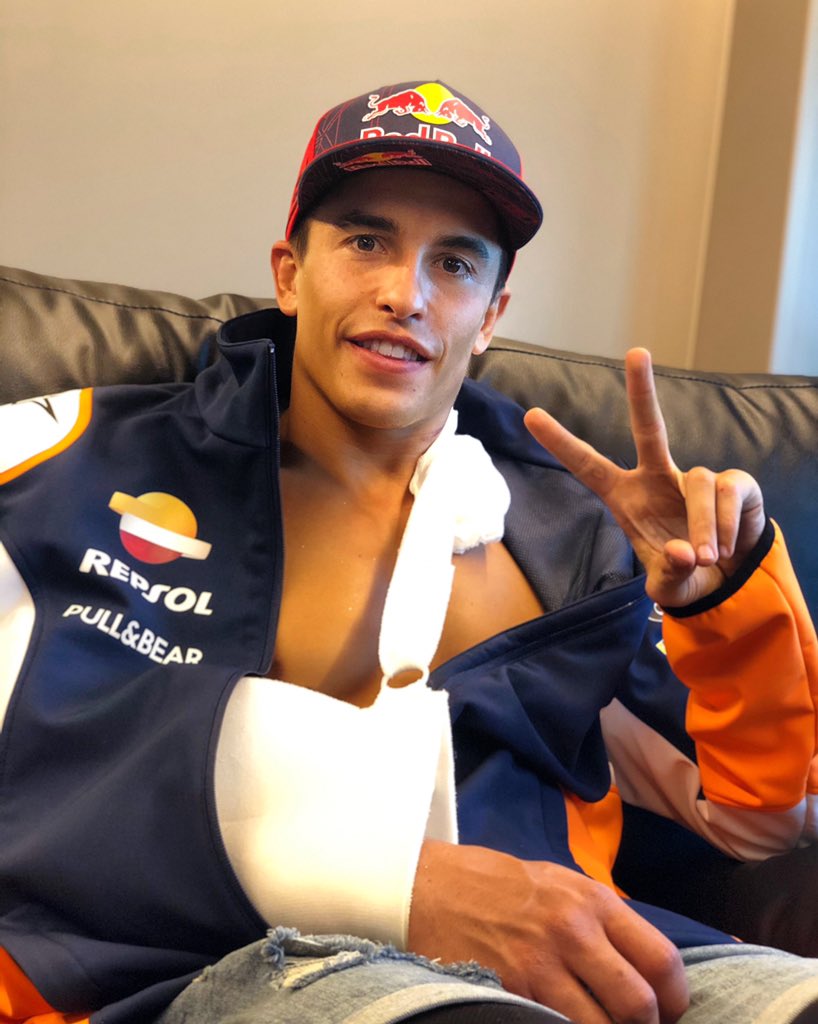 Duh! Marc Marquez Operasi Retak Lengan, Bisa Absen Lama
