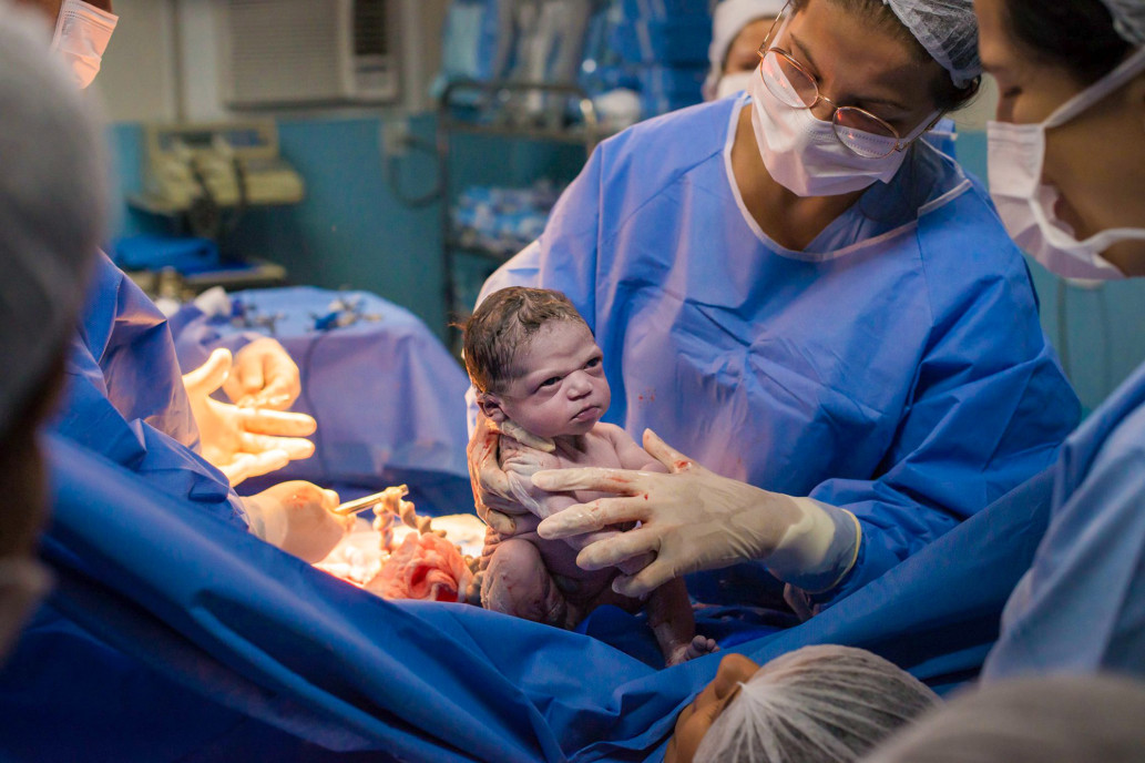 Viral Foto Bayi Baru Lahir di Brazil Langsung Cemberut, Gemas!