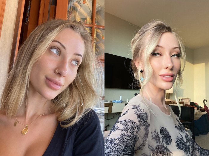 Instagram Tutup Akun Model LA Gara-gara Galang Donasi Kebakaran Australia Pakai Foto Bugil