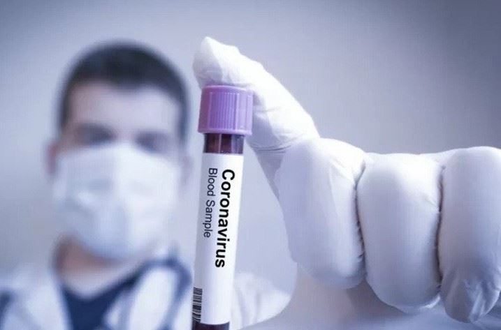 Dibanding Rapid Test, Pengguna Instagram Ini Klaim Immunoassay Lebih Akurat Deteksi COVID-19