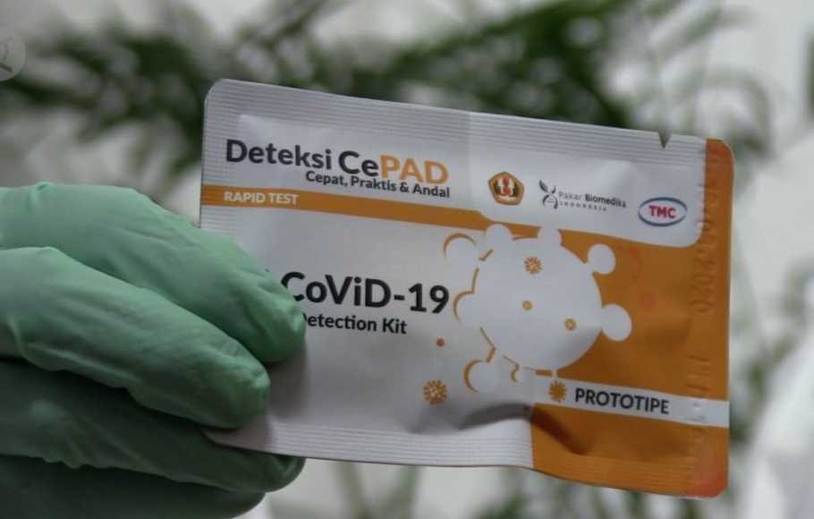 'CePAD', Rapid Test Antigen Unpad Punya Akurasi di Atas Standar WHO  