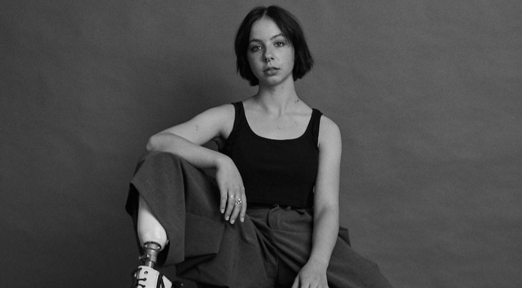 Kisah Iona Hay, Sukses Jadi Model Meski Kehilangan Kaki karena Kanker