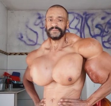Kecanduan Suntik Syntol sampai Dijuluki 'Hulk', Binaragawan Brazil Ini Tewas