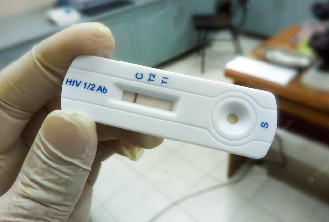 Dinkes Bandung Sebut Deteksi Dini HIV AIDS Dapat Tingkatkan Harapan Hidup