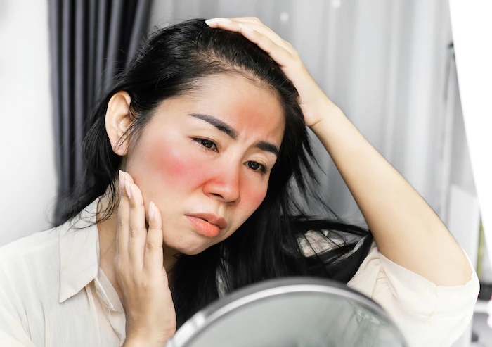 Kulit Sensitif? Bisa Jadi Ini Alasannya!