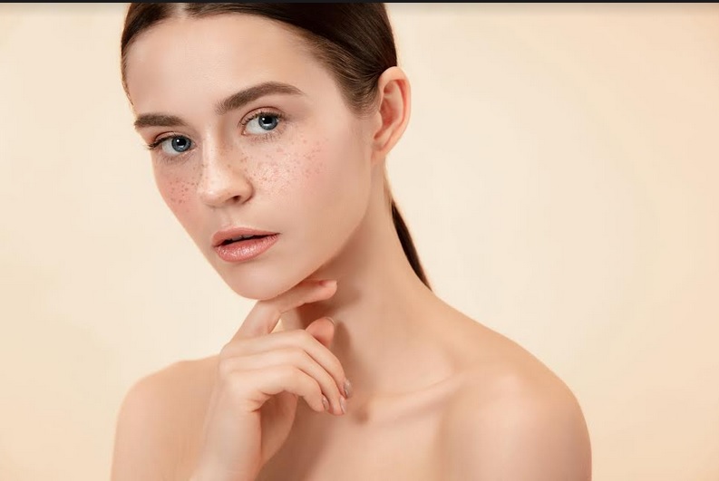 Dark Spot Bikin Makeup Tampak Kusam? Atasi dengan 4 Tips Berikut
